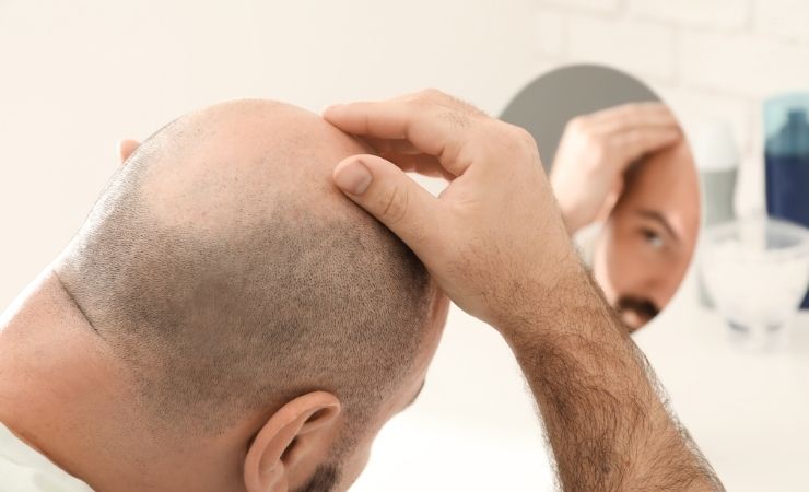 DHI Hair Transplant