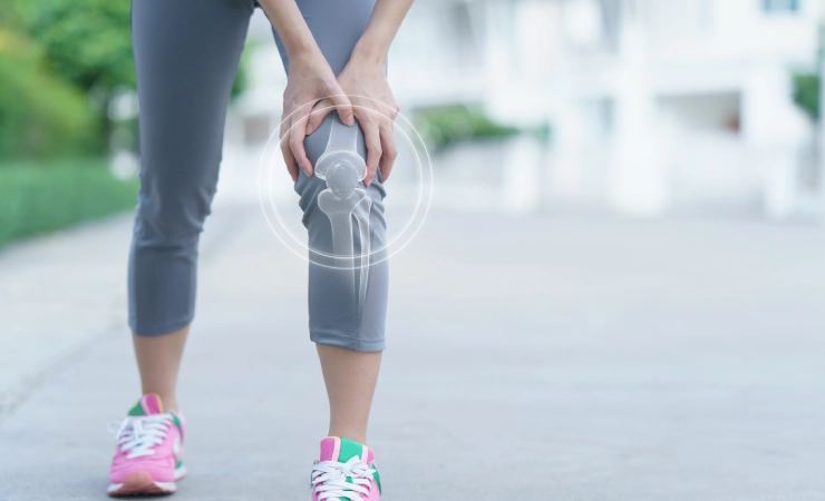 Knee Replacement