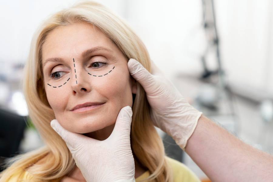 what is blepharoplasty?
