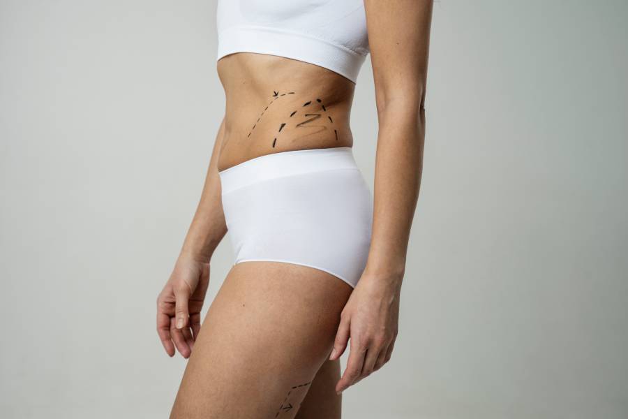 Is it normal to have lumps after liposuction?