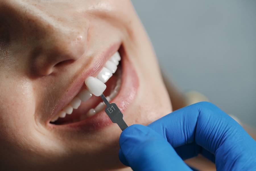Can you have dental implants with gum disease?