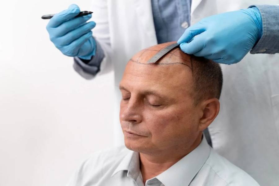 What is male pattern hair loss, and can it be treated?